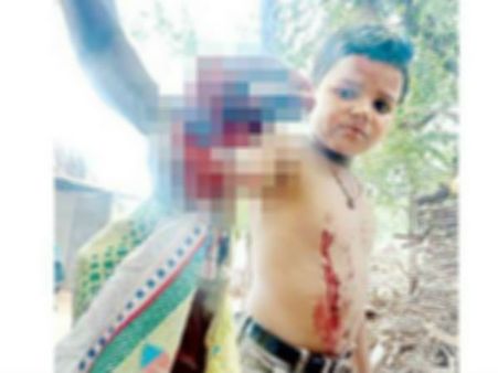 జాగ్రత్త అవసరం! చేతిలో పేలిన సెల్‌ఫోన్: తెగిపడిన బాలుడి వేళ్లు