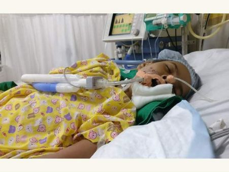 వెంటిలేటర్ సాయంతో మృత్యువుతో పోరాడుతున్న చిన్నారి విశాఖకి మన సాయం అవసరం