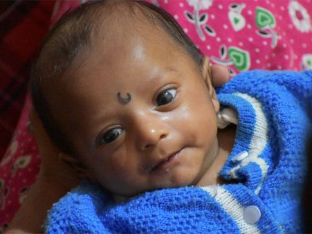 మీ సాయం ఆ బాబు చివరి సర్జరీ పూర్తయ్యేలా చేస్తుంది: ఒక నిండు ప్రాణాన్ని నిలబడుతుంది