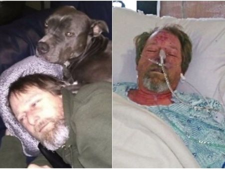 కుక్క ఉంది జాగ్రత్త: ఈ వ్యక్తి కాళ్లు చేతులు డాక్టర్లు తీసేశారు..తెలిస్తే షాక్ అవుతారు