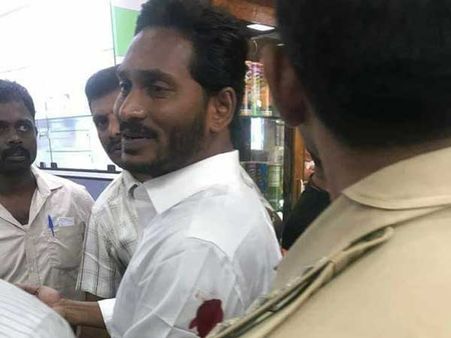 ట్విస్ట్: 'జగన్‌పై ప్రాణాపాయంలేని దాడి జోస్యం నిజమైంది, సీఎం చేయాలనే పిచ్చి అభిమానమే'