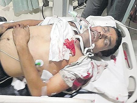 కాల్పుల కలకలం:నెల్లూరులో వ్యాపారి కాల్చివేత;నగరంలో హై అలర్ట్ ప్రకటించిన పోలీసులు