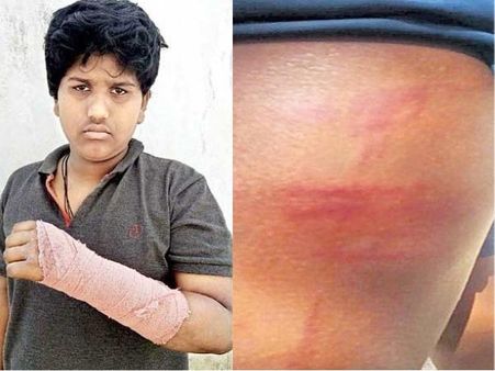 తప్పతాగి, కర్ర చేతబట్టి.. రెచ్చిపోయిన 'వాచ్‌మెన్'