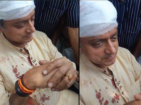 తిరగబడ్డ తులాభారం! శశిథరూర్ తలకు గాయాలు..ఆరు కుట్లేసిన డాక్టర్లు!