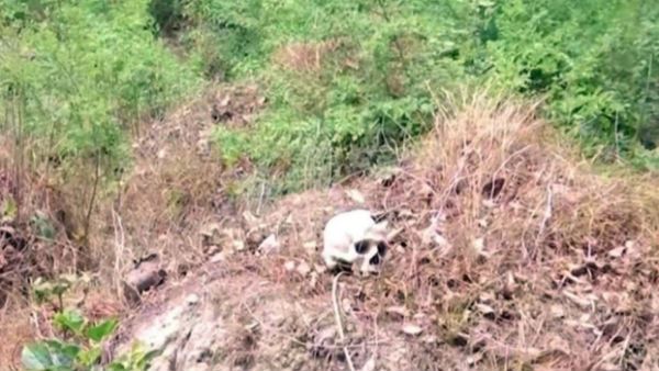 వామ్మో .. ముజఫర్‌నగర్ ఆస్పత్రి వద్ద ఎముకలు, పుర్రె ...