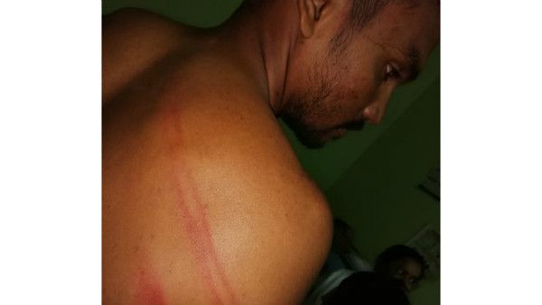 కర్రలు లేచాయి.. అటవీ అధికారుల వీపులు పగిలాయి.. కొత్తగూడెంలో మరో దాడి