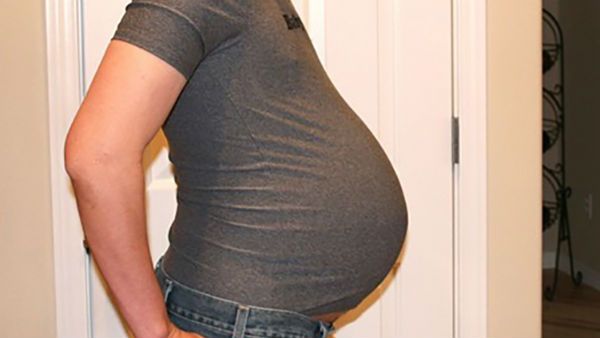 జంబలకిడిపంబ : జ్వరంతో హాస్పిటల్‌కు వెళ్లిన వ్యక్తి .. కడుపుతో ఉన్నాడని తేల్చిన ల్యాబ్ రిపోర్ట్..