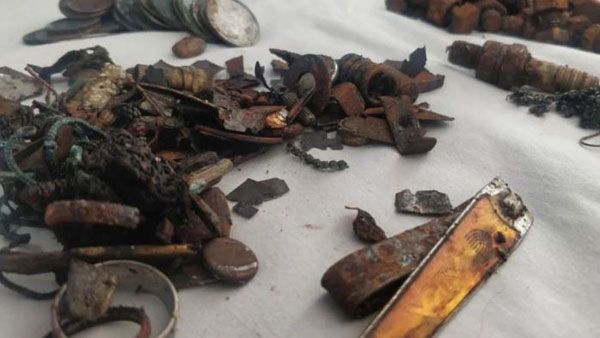 కడుపులో ఇనుము.. 3.5 కిలోల 452 వస్తువులు.. ఎలా భరించాడో పాపం..!