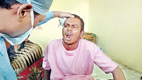 భార్యపై కోపం.. నాలుక ఖతం.. ఓ భర్త చేసిన పనికి..!