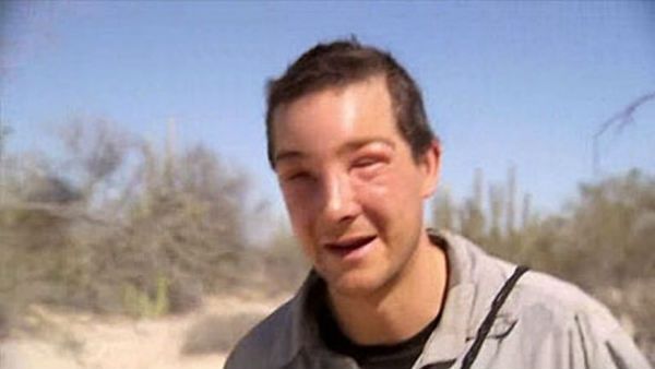 బేర్ గ్రిల్స్ ఈజ్ బ్యాక్: తేనేటీగల దాడి తర్వాత ఈ సాహసికుడు ఎలా ఉన్నాడో చూడండి..!