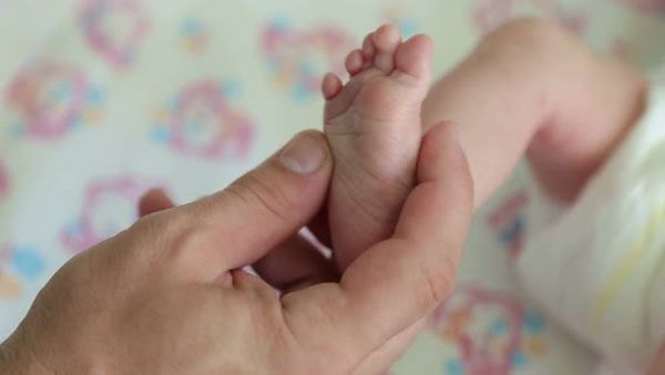 రెండు తలలు, మూడు చేతులు:కవలలు అనుకుంటే.. ఒక్క చిన్నారే, ఇలా...