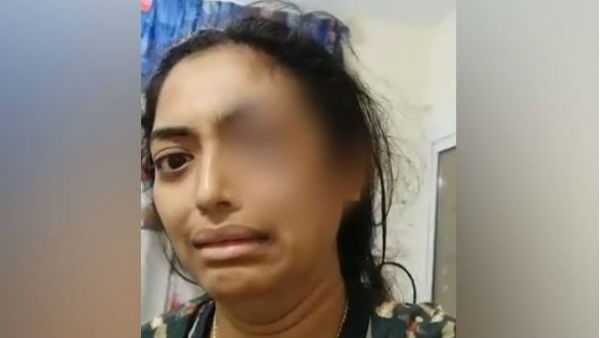 భర్త రూప రాక్షసుడు: కంటిపై కొట్టి, చేయి తిప్పి, పక్కటెముకల్లో గుద్ది.. వివాహితకు చిత్రహింసలు