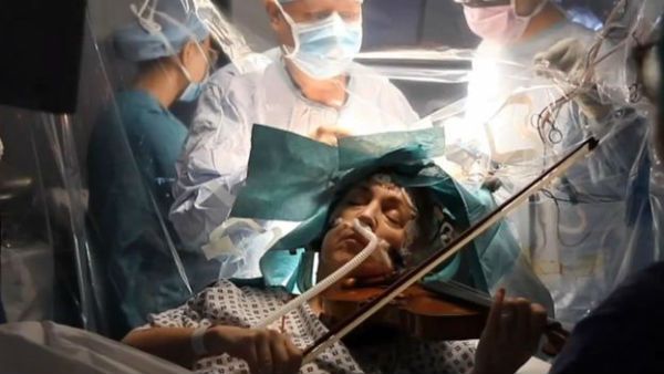 వైద్యచరిత్రలో అపూర్వ ఘట్టం: వయొలిన్ వాయిస్తుండగా ఆపరేషన్, కణితి తీసిన లండన్ వైద్యులు (వీడియో)