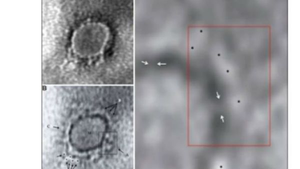 భారత శాస్త్రవేత్తల ఘనత: Coronavirus తొలి మైక్రోస్కోపిక చిత్రం ఇదే