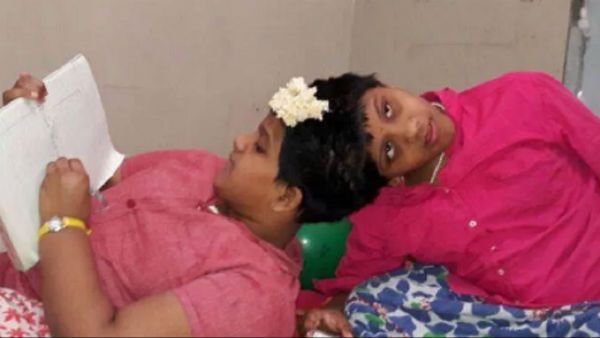 అవిభక్త కవలల అవిశ్రాంత పోరాటం.. పదో తరగతి పరీక్షలకు వీణావాణీలు సిద్ధం