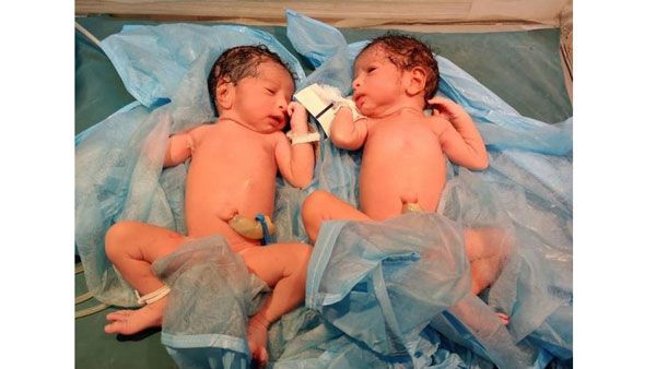 కవలలకు జన్మనిచ్చిన కరోనా పాజిటివ్ మహిళ.. గాంధీ ఆస్పత్రిలో పురుడుపోసిన వైద్యులు