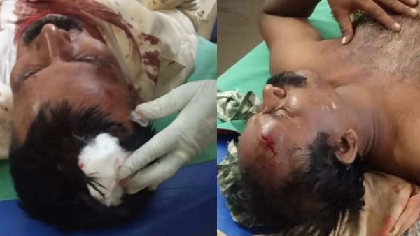 బైరెడ్డి Vs బైరెడ్డి: కుటుంబంలో భగ్గుమన్న వర్గపోరు: సినీ ఫక్కీలో కొట్టుకున్న రెండు గ్రూపులు