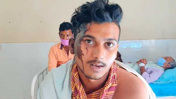 సీన్ రివర్స్ .. ఏపీలో ప్రియుడిపై యాసిడ్ పోసిన ప్రియురాలు .. కారణం ఇదే !!