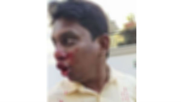 షేక్‌పేట్ డివిజన్‌లో బీజేపీ నేతపై ఎంఐఎం నేతల దాడి, తీవ్రగాయాలు: కారు గుర్తు హైలెట్!