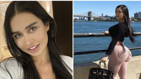 పిరుదులపై ప్రేమ ప్రాణం తీసింది -లైవ్​లో చూసి షాక్​ -సర్జరీ వికటించి ప్రముఖ మోడల్ మృతి