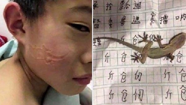 షాకింగ్ : హోమ్ వర్క్ చేస్తూ నిద్రలోకి... లేచి చూసుకుంటే ముఖంపై బల్లి అచ్చు...