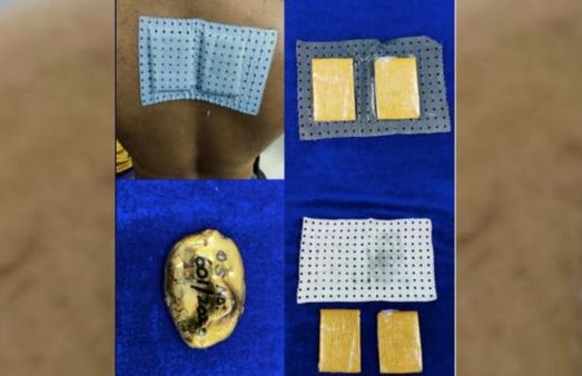 వీరు మాములు కేడీలు కాదు కదా..? గుండుపై బంగారం పేస్ట్.. స్మగ్లింగ్