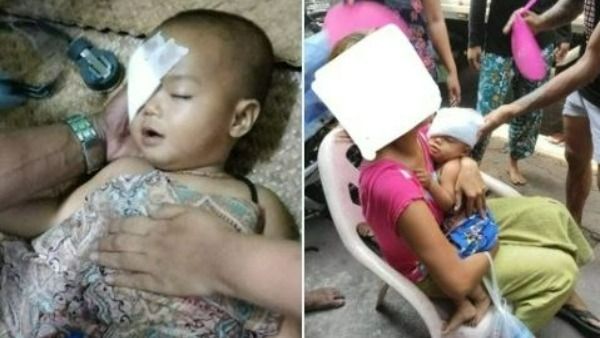 మయన్మార్‌లో సైన్యం మారణహోమం: 91 మంది మృతి, చిన్నారి కంటికి తగిలిన బుల్లెట్(వీడియో)