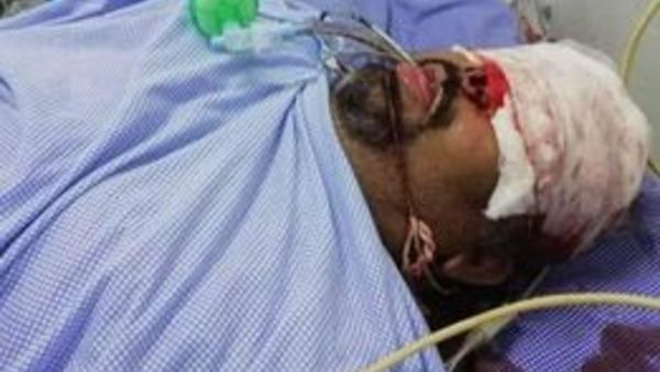 నెల్లూరు జిల్లాలో లారీని ఢీకొన్న ఇన్నోవా కారు: కత్తి మహేష్‌కు తీవ్ర గాయాలు