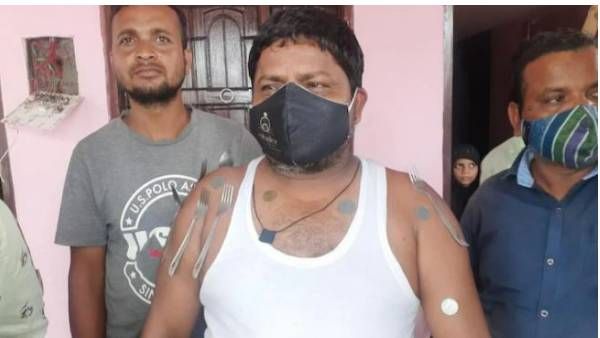 ఏంటీ వింత-కోవిడ్ వ్యాక్సిన్‌తో అయస్కాంత శక్తి-శరీరానికి అతుక్కుంటున్న ఇనుప వస్తువులు