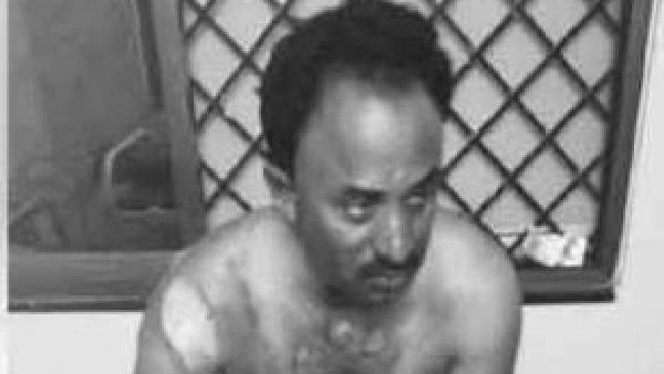 దారుణం: ఉపాధి హామీ అధికారిపై పెట్రోల్ పోసి నిప్పంటించిన సర్పంచ్