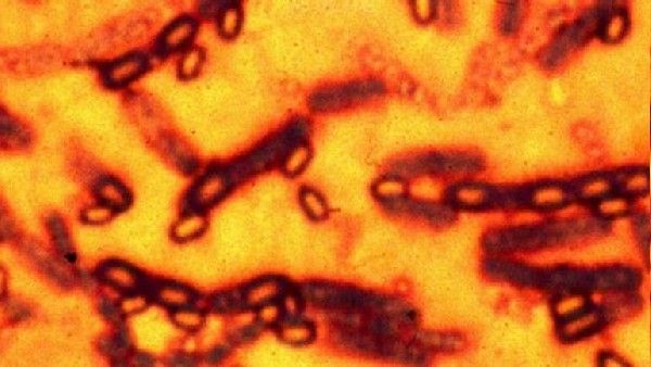 ఇక ఆంత్రాక్స్ వంతు.. ఆంత్రాక్స్ న్యూమోనియా.. చైనాలో వెలుగులోకి..