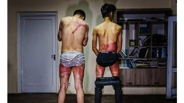 ఒంటిపై రక్తం తేలేలా-జర్నలిస్టులకు నరకం చూపించిన తాలిబన్లు-ఎంత చిత్రహింసలకు గురిచేశారంటే...