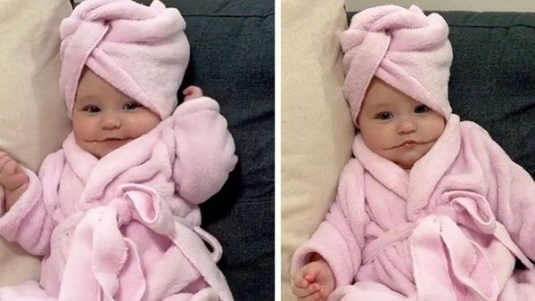 ఎప్పటికీ నవ్వుతూనే... అరుదైన సమస్య; శాశ్వత చిరునవ్వుతో జన్మించిన పాప