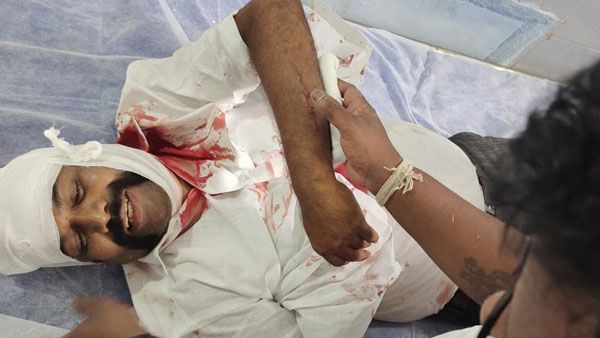 ధర్మవరం వైసీపీ ఎమ్మెల్యేపై కబ్జా ఆరోపణలు-బీజేపీ నేతల్ని చితకొట్టిన వైనం- తీవ్ర గాయాలు