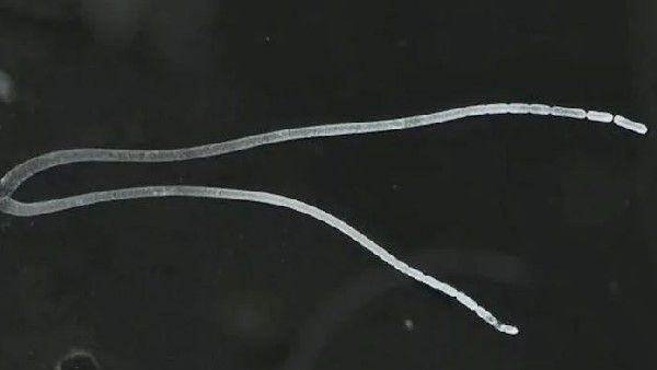 అతిపెద్ద బ్యాక్టీరియా..సేమియా షేప్‌లో: ఏకకణ జీవుల్లో ఎవరెస్ట్