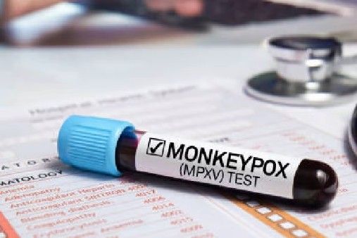 మరో మంకీపాక్స్ కేసు.. మరింత ముమ్మరంగా తనిఖీలు, కేంద్రం ఆదేశం