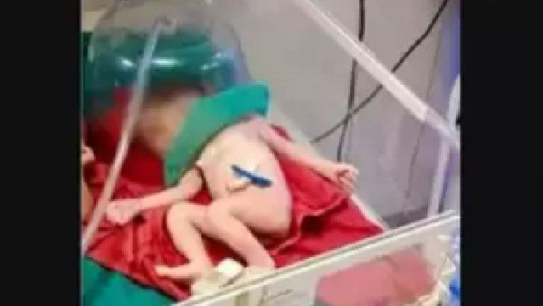 Viral news: గర్భిణీని ఢీకొట్టిన లారీ.. తల్లి కడుపులోంచి బయటకు వచ్చిన శిశువు..