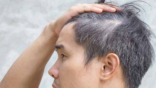 health tips: యువతలో తెల్లజుట్టు సమస్య; టెన్షన్ పక్కనపెట్టి ఈ చిట్కాలు ట్రై చెయ్యండి!!