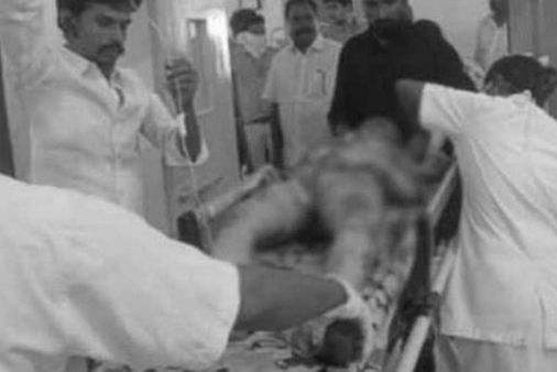 Diwali 2022: టపాసులు పేలి బాలుడు మృతి.. సరోజినీదేవి కంటి ఆస్పత్రికి పేషెంట్ల తాకిడి..