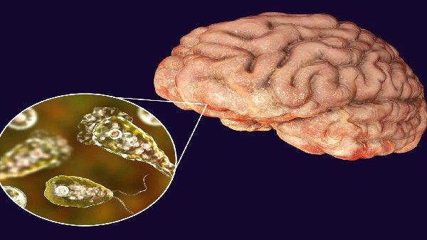 Naegleria Fowleri : మెదడు తినేసే అమీబా- కొరియాలో తొలి మరణం- భారత్ లోనూ..