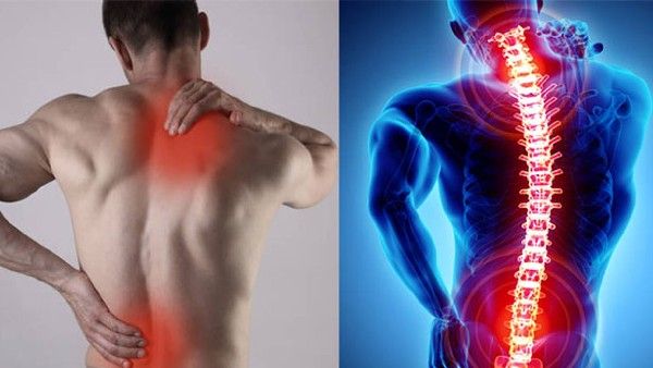 health tips: విపరీతంగా ఒళ్ళునొప్పులా? పెయిన్ కిల్లర్స్ వాడకండి; నేచురల్ రెమిడీస్ ట్రై చెయ్యండి!!