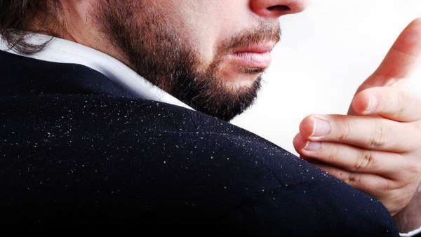 Dandruff: చుండ్రు సమస్య వేధిస్తుందా.. అయితే ఈ పని చేయండి చాలు..! 