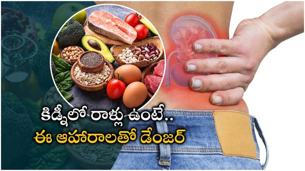 helath tips: కిడ్నీలలో రాళ్ళను నేచురల్ గా కరిగించెయ్యండి; ఈ రెమిడీస్ ట్రై చెయ్యండి!!