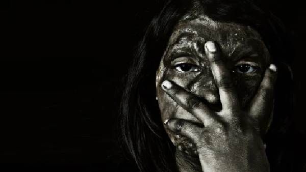 అర్దరాత్రి కోడలి ప్రైవేట్ పార్ట్స్ మీద యాసిడ్ పోసిన అత్త, భర్త విదేశాల్లో, నీకు ఎంత ధైర్యం ఉంటే ఇలా ?