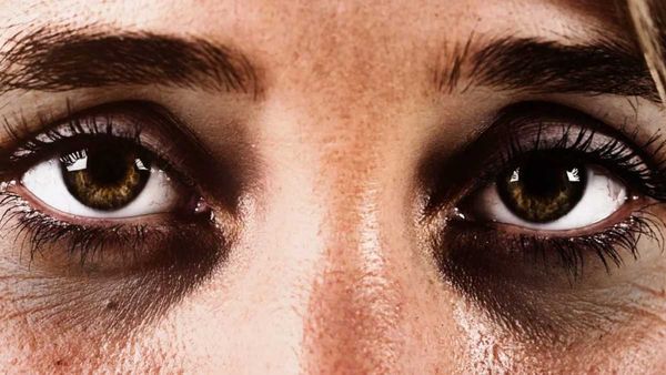 కళ్లకింద నల్లటి వలయాలుంటే ఇలా చేయండి!