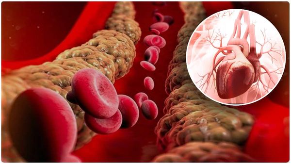 health tips: ట్రైగ్లిజరైడ్స్ సమస్య.. గుండెకు చాలా డేంజర్.. బీ అలెర్ట్!!