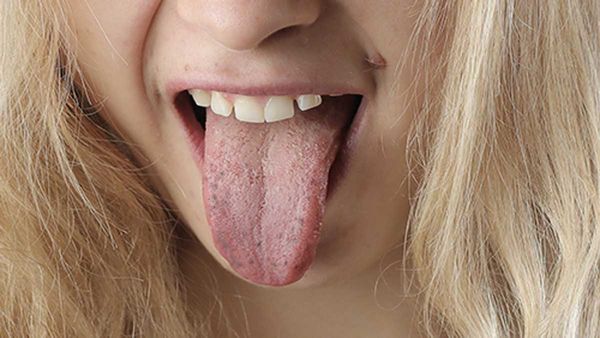 నాలుకపై మచ్చలు ఉన్నవారు తిడితే నిజమవుతాయా? ఏం చెప్పినా జరుగుతుందా? తెలుసుకోండి!!