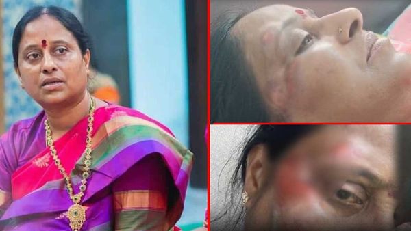 Konda Surekha: రోడ్డు ప్రమాదంలో గాయపడిన మాజీ మంత్రి కొండా సురేఖ ..