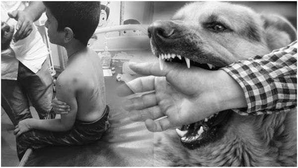 ఆరేళ్ళ బాలుడిపై 5 వీధికుక్కల దాడి; గుంటూరులో దారుణ ఘటన!!