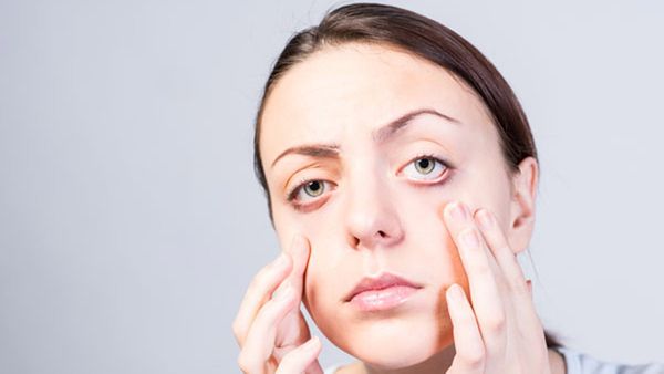 Health tips: కళ్ళవాపు, చర్మ సమస్యలు.. నిర్లక్ష్యం చేస్తే కిడ్నీలకు ముప్పు.. ఎలాగంటే!!